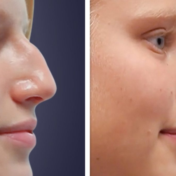 Innovative Approaches to Modern Facial Rejuvenation